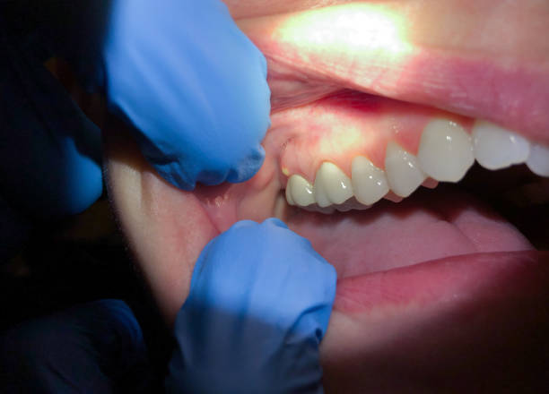 Best Walk-In Emergency Dentist in Violet, LA