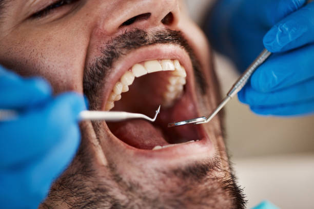 Best After-Hours Emergency Dentist in Violet, LA