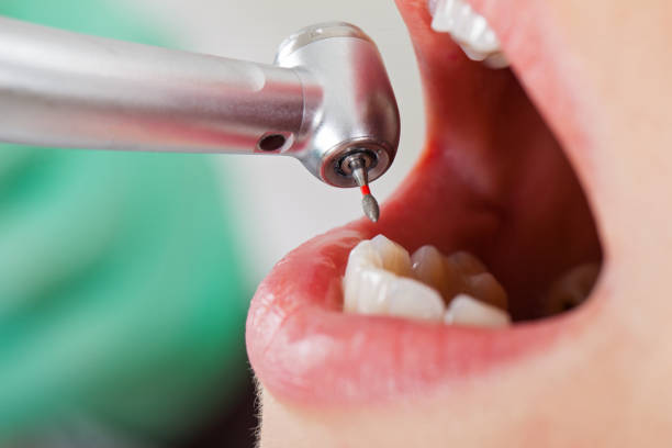 Best Emergency Dental Surgery in Violet, LA